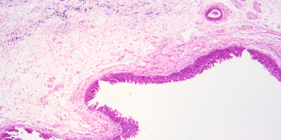 Ureaplasma: What Is It, Is It an STI, and Does It Actually Need Treatment?