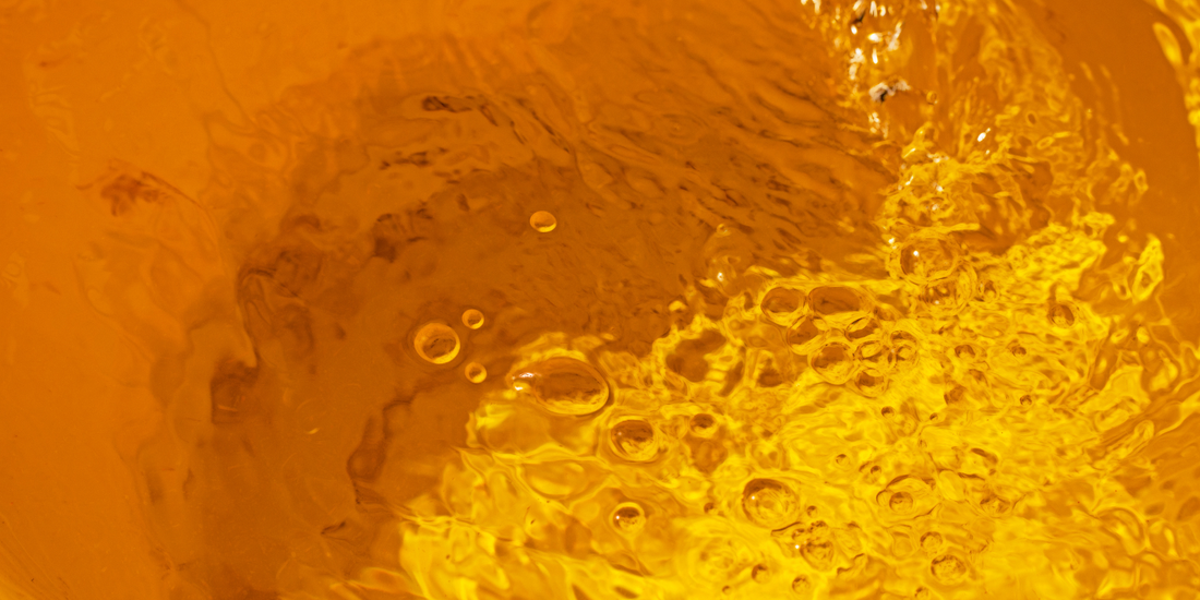 Why Do I Feel Like I Have to Pee All the Time? What Urinary Frequency Can Tell You